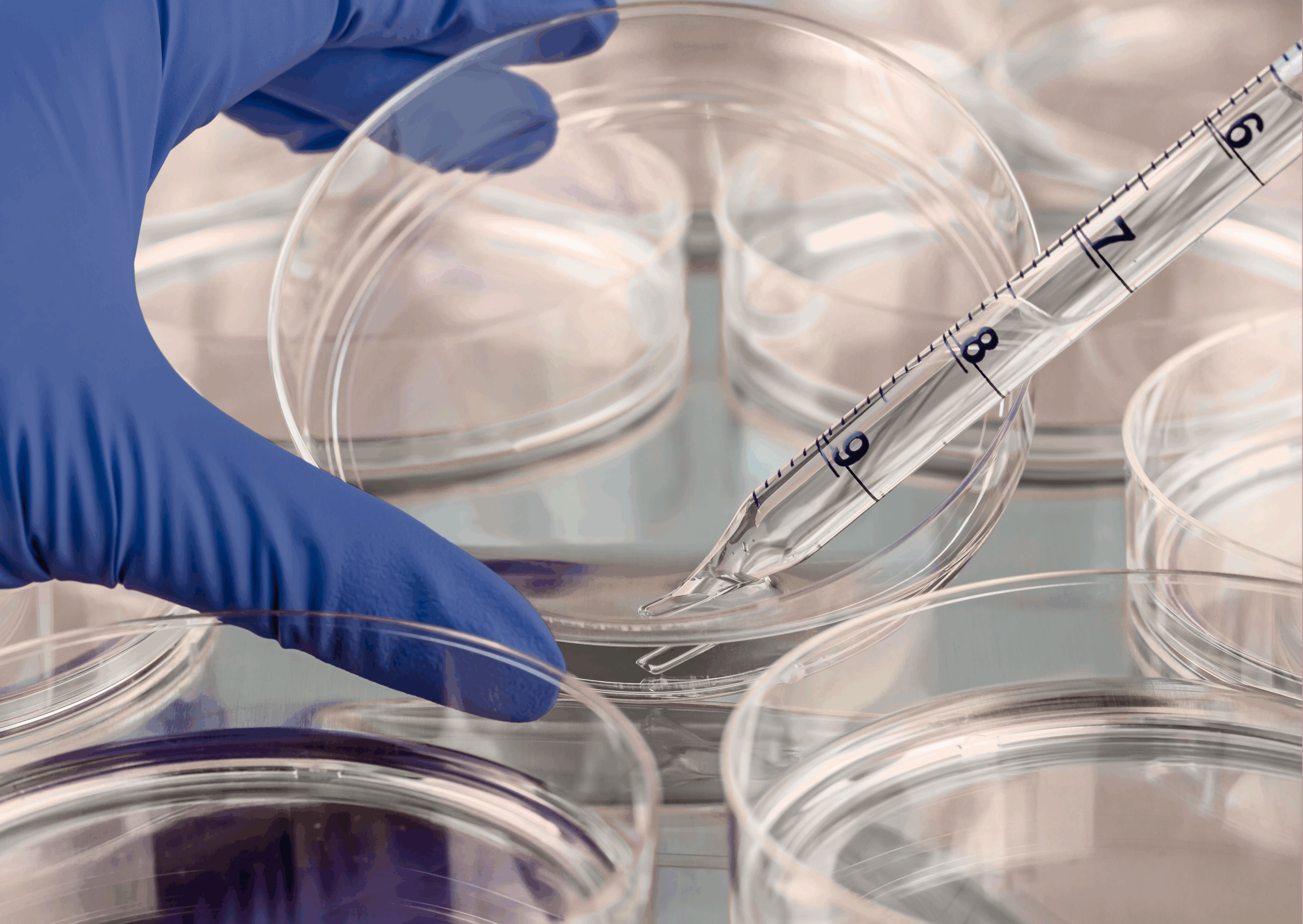 Tecnico con guanto blu prepara test di citotossicità su dispositivi medico-diagnostici in vitro (IVD)